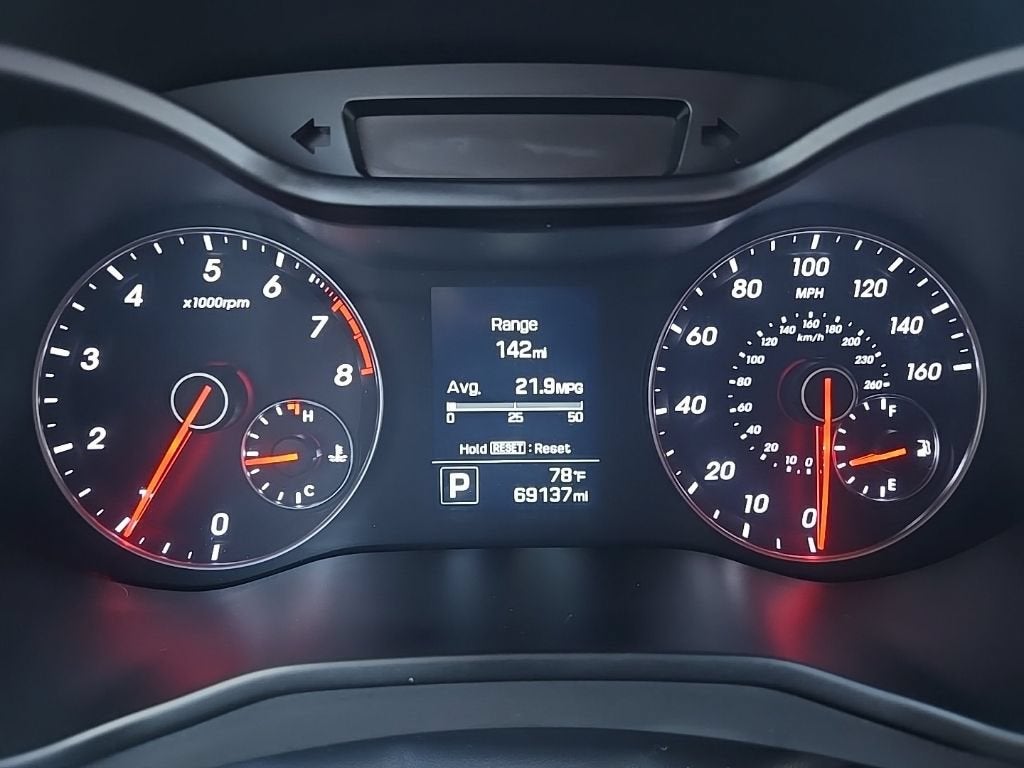 2017 Hyundai Veloster Turbo